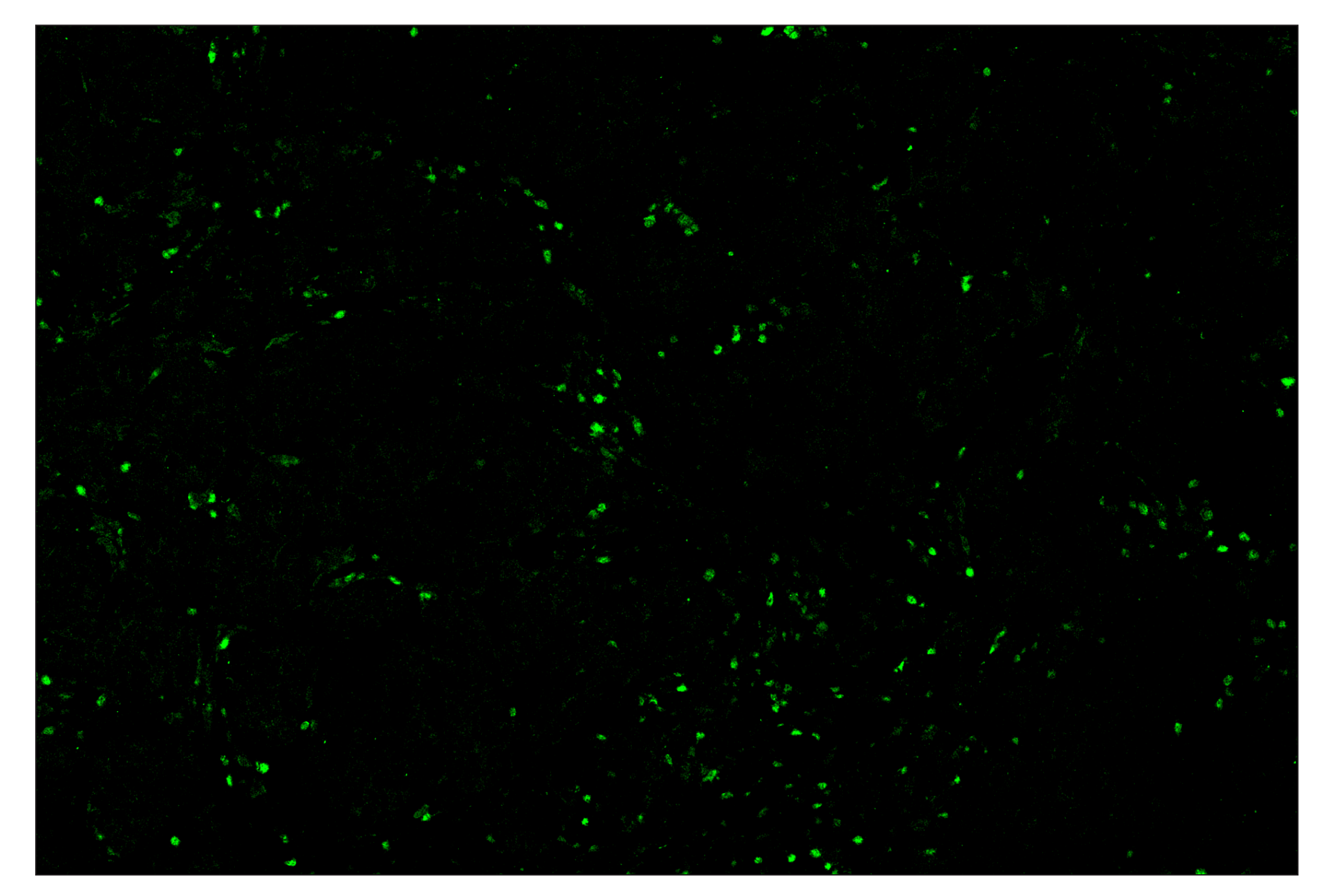 Immunohistochemistry Image 2: Tox/Tox2 (E6I3Q) & CO-0016-594 SignalStar™ Oligo-Antibody Pair