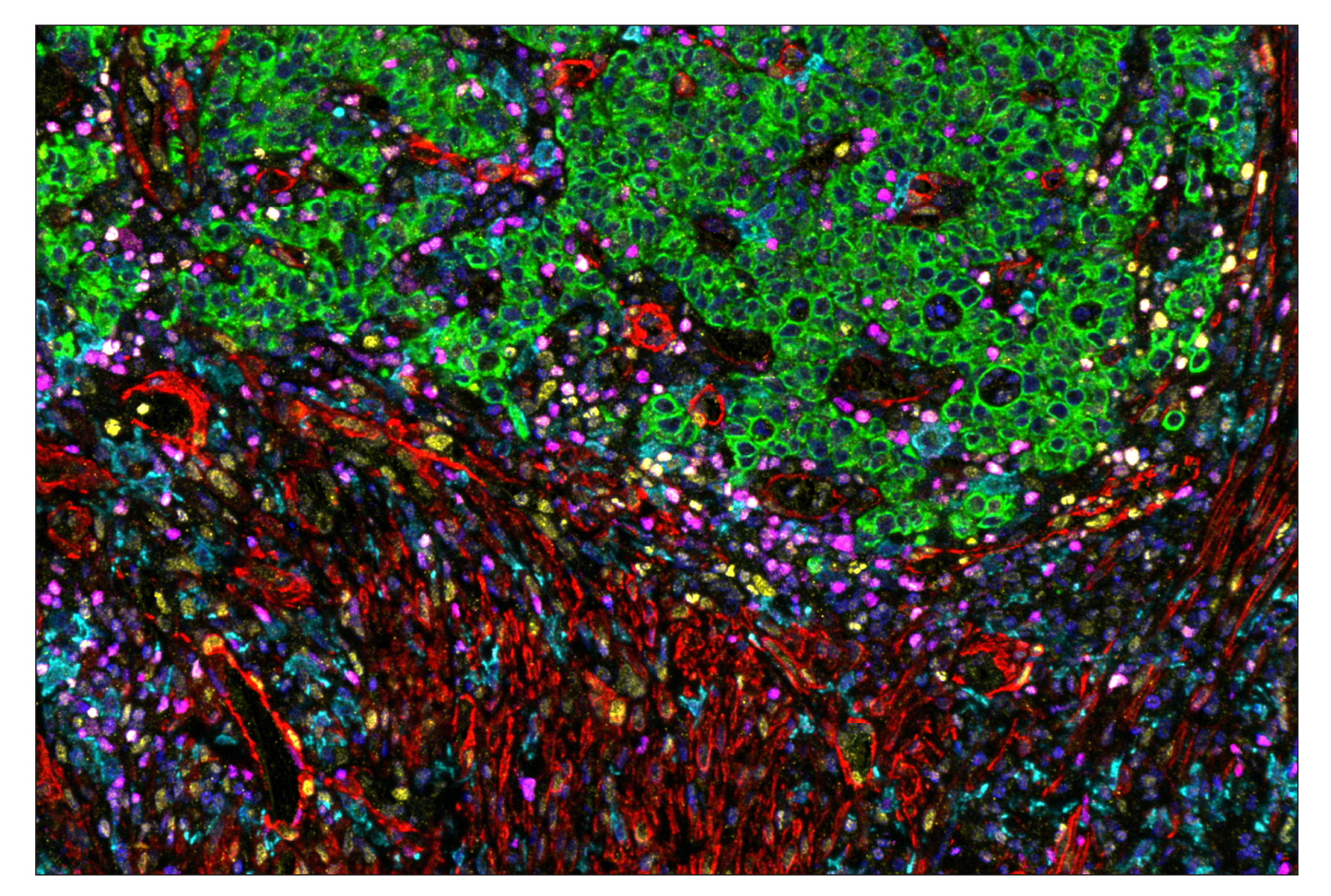 Immunohistochemistry Image 1: Tox/Tox2 (E6I3Q) & CO-0016-647 SignalStar™ Oligo-Antibody Pair