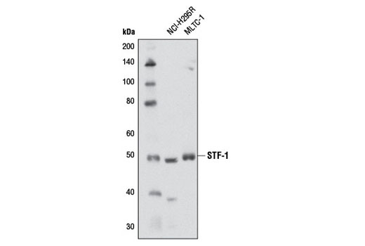 Western Blotting Image 1: STF-1 Antibody