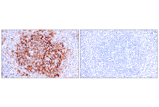 Immunohistochemistry Image 5: CD23 (E1R4G) Rabbit mAb
