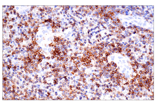 Immunohistochemistry Image 1: CD23 (E1R4G) Rabbit mAb