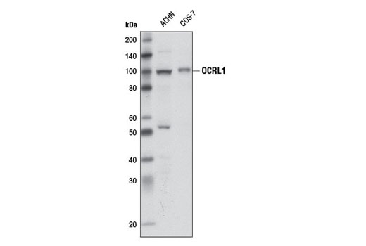 Western Blotting Image 1: OCRL1 Antibody