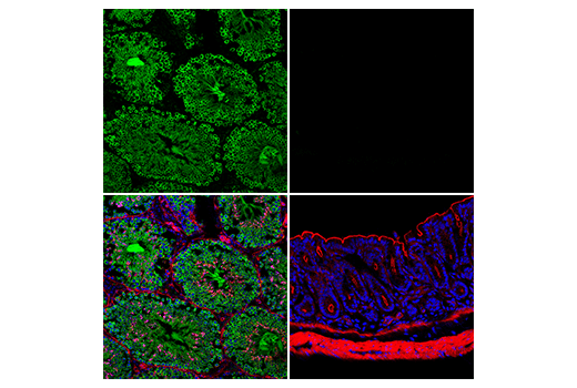 Immunofluorescence Image 1: Ly6k (E3M7W) Rabbit mAb
