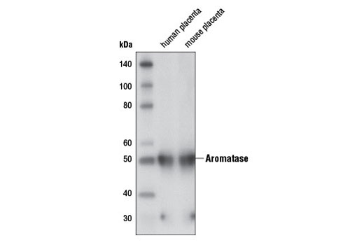 Western Blotting Image 1: Aromatase Antibody