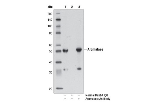 Immunoprecipitation Image 1: Aromatase Antibody