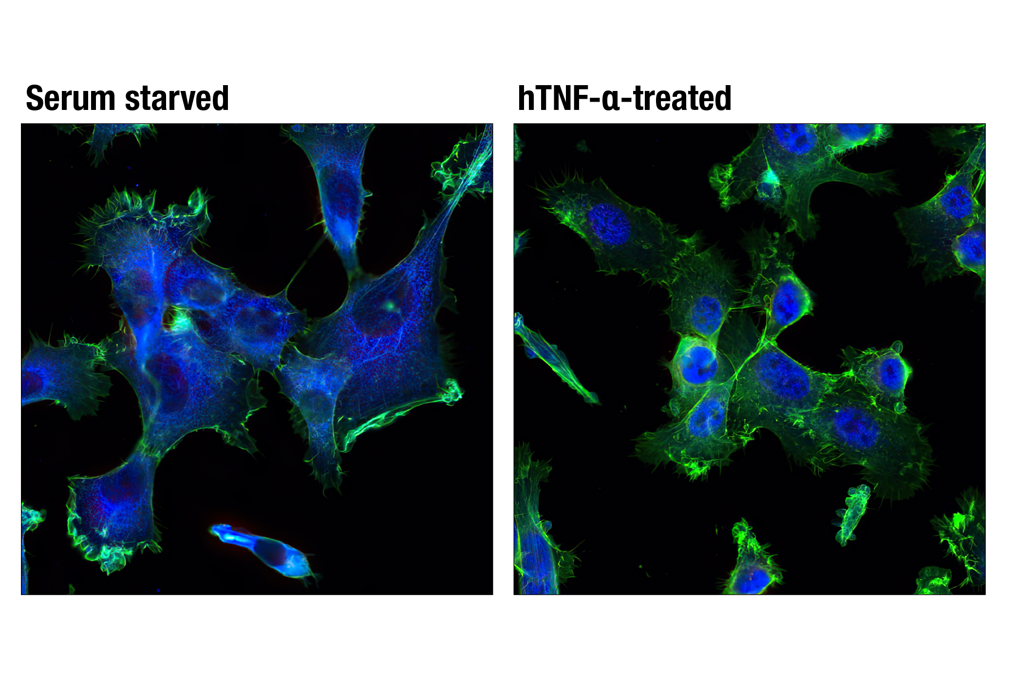 Immunofluorescence Image 1: NF-κB p65 (D14E12) XP® Rabbit mAb (Alexa Fluor® 647 Conjugate)