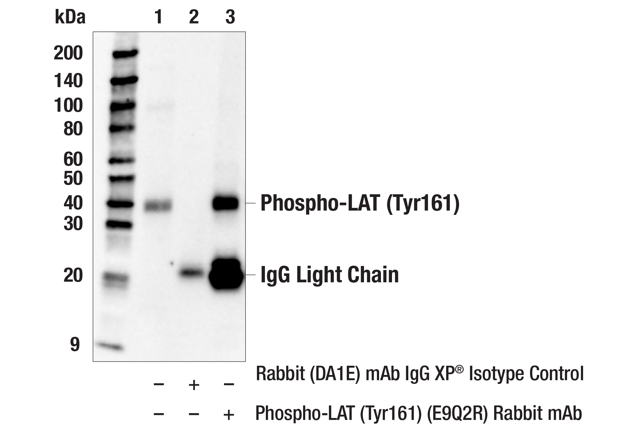Immunoprecipitation Image 1: Phospho-LAT (Tyr161) (E9Q2R) Rabbit mAb