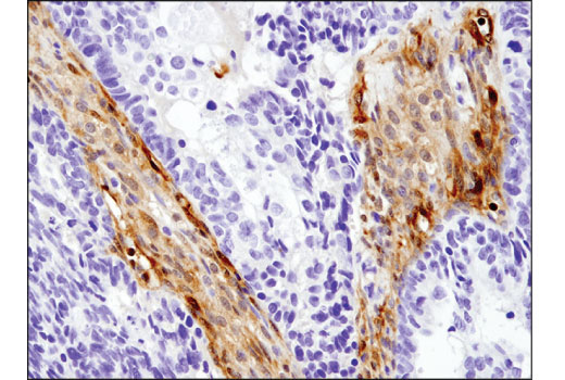 Immunohistochemistry Image 2: Galectin-1/LGALS1 (8A12) Mouse mAb (BSA and Azide Free)