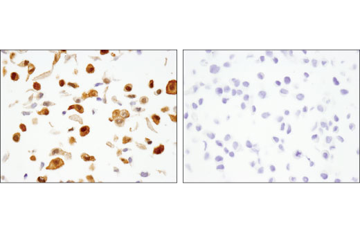 Immunohistochemistry Image 3: Galectin-1/LGALS1 (8A12) Mouse mAb (BSA and Azide Free)