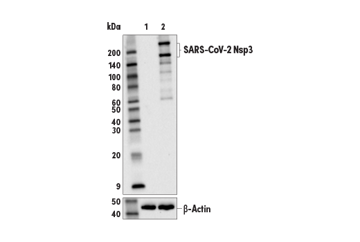 Western Blotting Image 1: SARS-CoV-2 Nsp3 Antibody