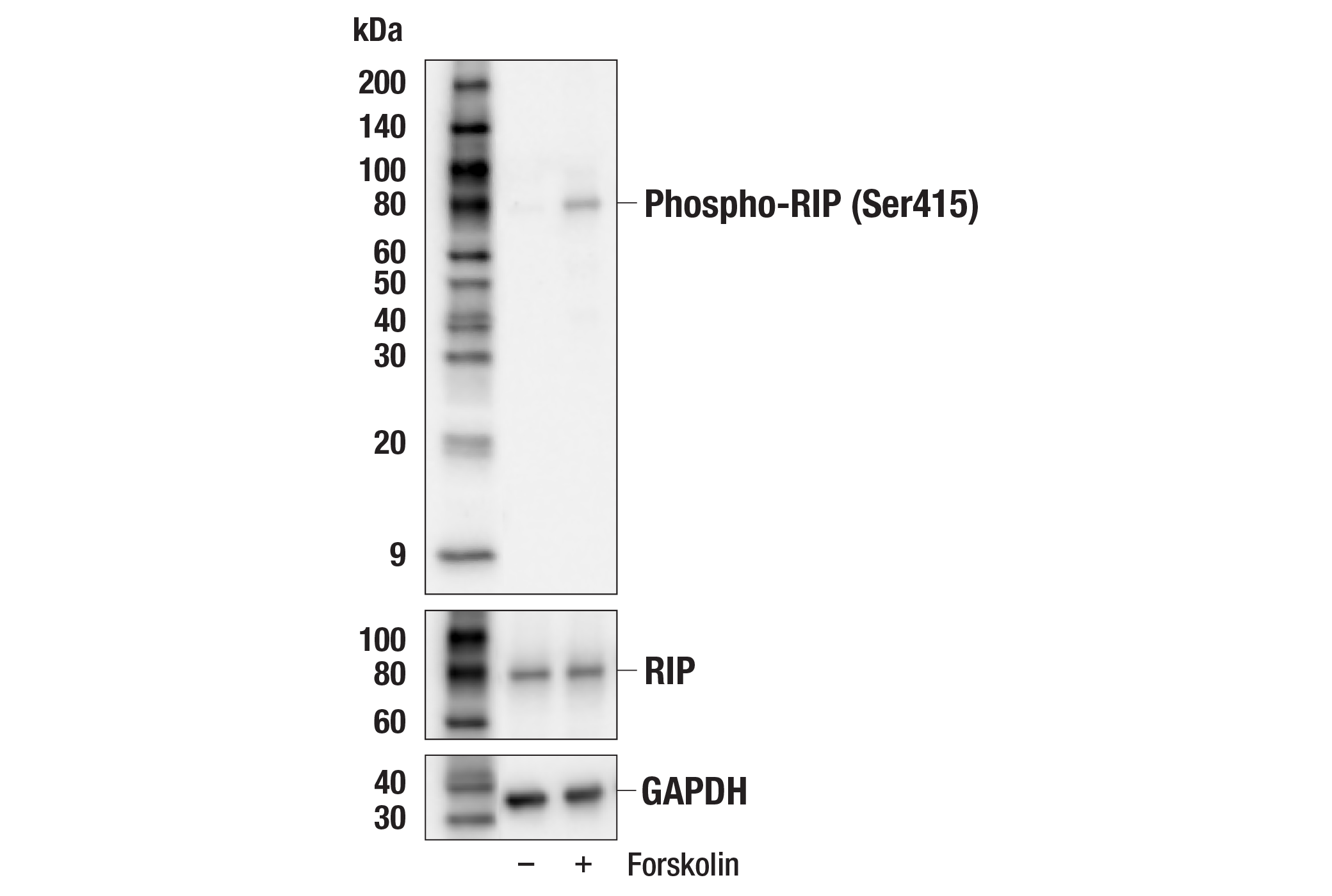 Western Blotting Image 1: Phospho-RIP (Ser415) Antibody