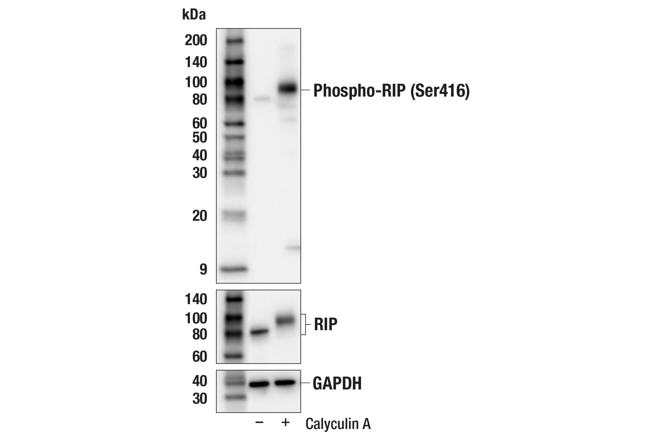 Western Blotting Image 2: Phospho-RIP (Ser415) Antibody