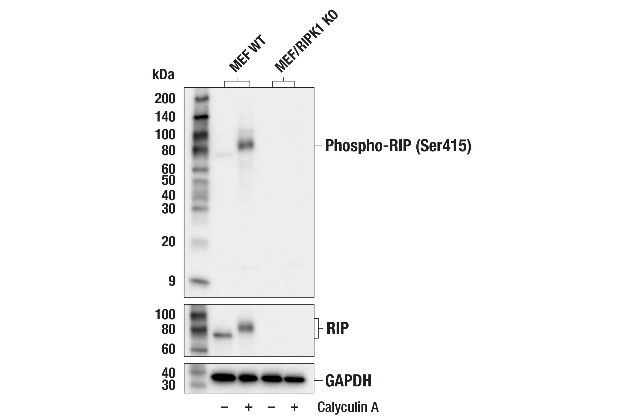 Western Blotting Image 3: Phospho-RIP (Ser415) Antibody