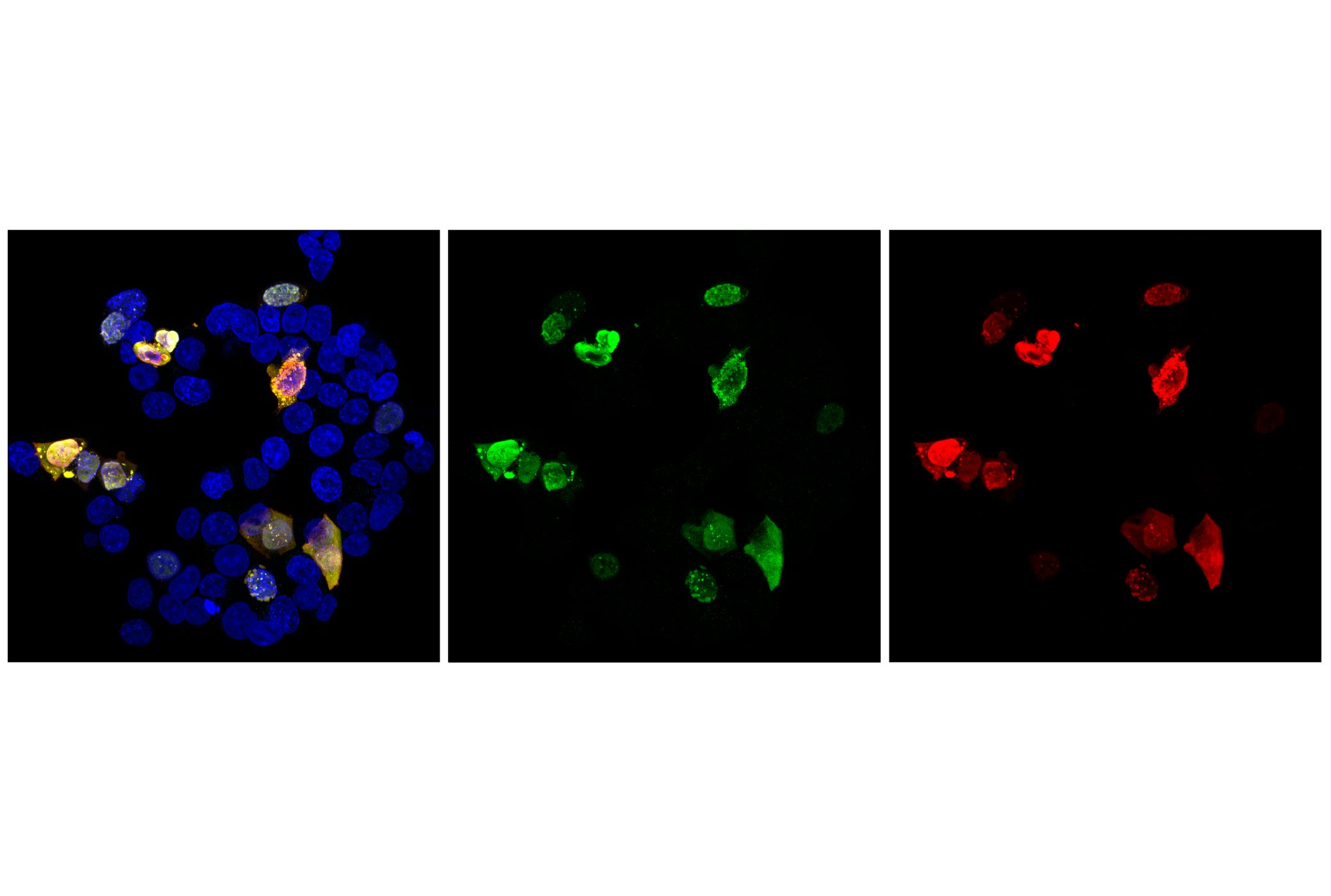 Immunofluorescence Image 1: VCre Recombinase (F3Q3G) Rabbit mAb