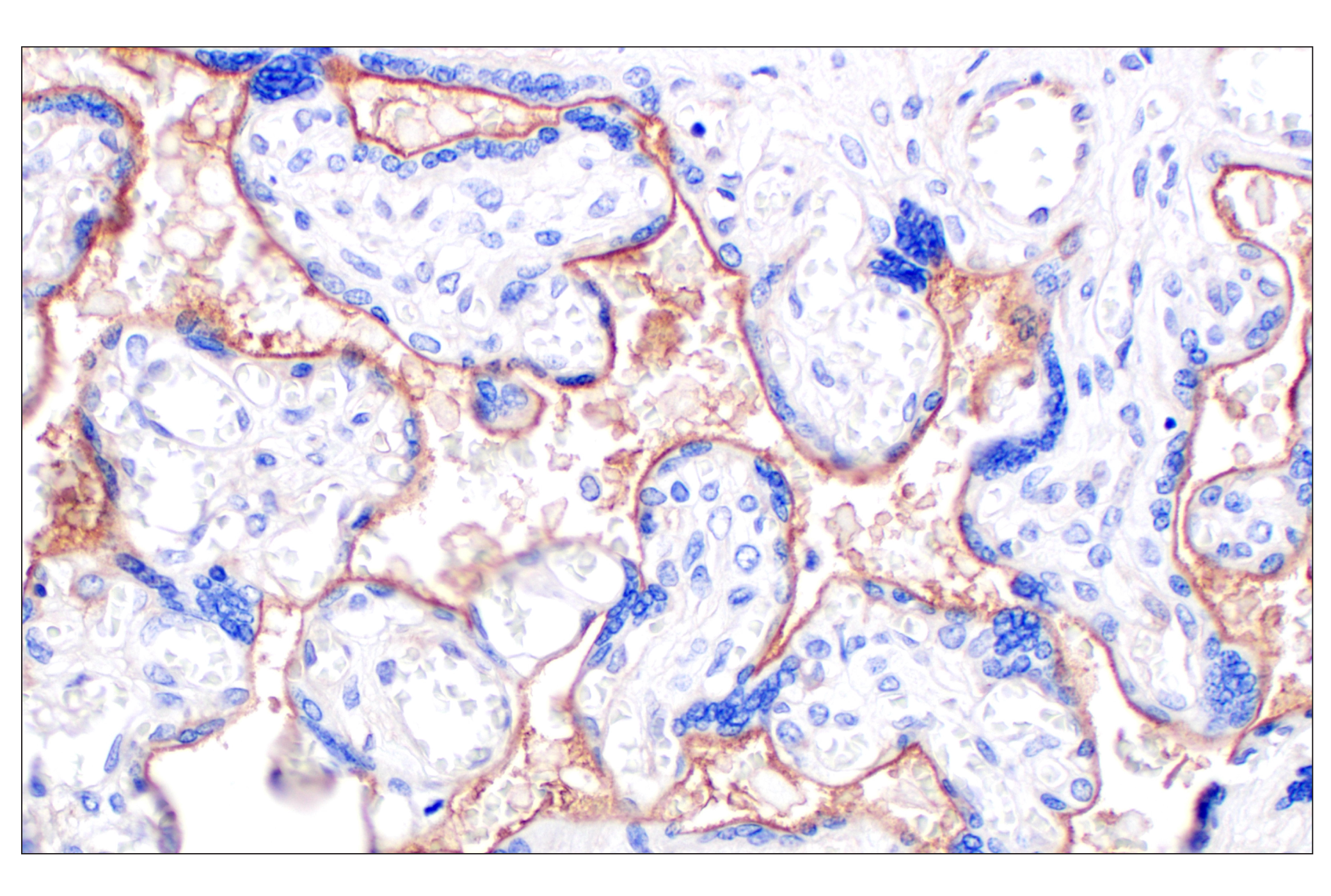 Immunohistochemistry Image 4: CD105/Endoglin (F9C5Q) Rabbit Monoclonal Antibody (BSA and Azide Free)