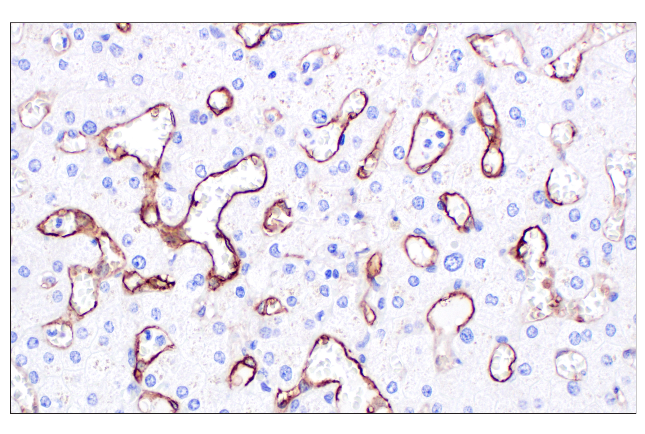 Immunohistochemistry Image 7: CD105/Endoglin (F9C5Q) Rabbit Monoclonal Antibody (BSA and Azide Free)