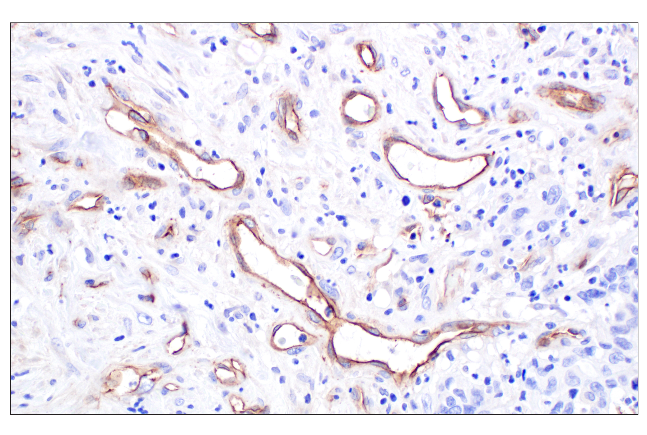 Immunohistochemistry Image 1: CD105/Endoglin (F9C5Q) Rabbit Monoclonal Antibody (BSA and Azide Free)