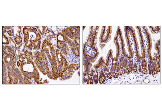 Immunohistochemistry Image 2: Non-phospho (Active) β-Catenin (Ser33/37/Thr41) (D13A1) Rabbit mAb