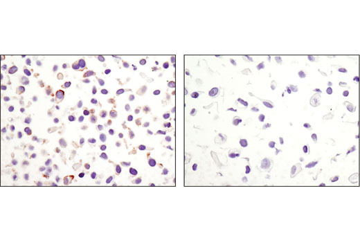 Immunohistochemistry Image 3: Non-phospho (Active) β-Catenin (Ser33/37/Thr41) (D13A1) Rabbit mAb