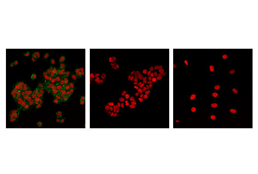Immunofluorescence Image 1: Non-phospho (Active) β-Catenin (Ser33/37/Thr41) (D13A1) Rabbit mAb