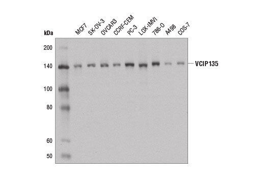 Western Blotting Image 1: VCIP135 Antibody