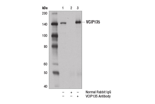 Immunoprecipitation Image 1: VCIP135 Antibody