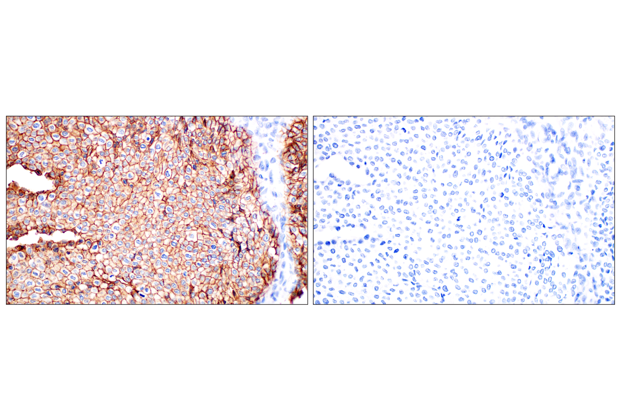 Immunohistochemistry Image 13: TACSTD2/TROP2 (F4W4J) Rabbit mAb (BSA and Azide Free)