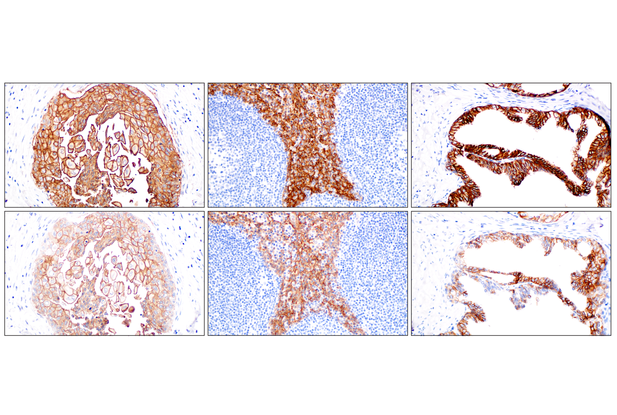Immunohistochemistry Image 12: TACSTD2/TROP2 (F4W4J) Rabbit mAb (BSA and Azide Free)
