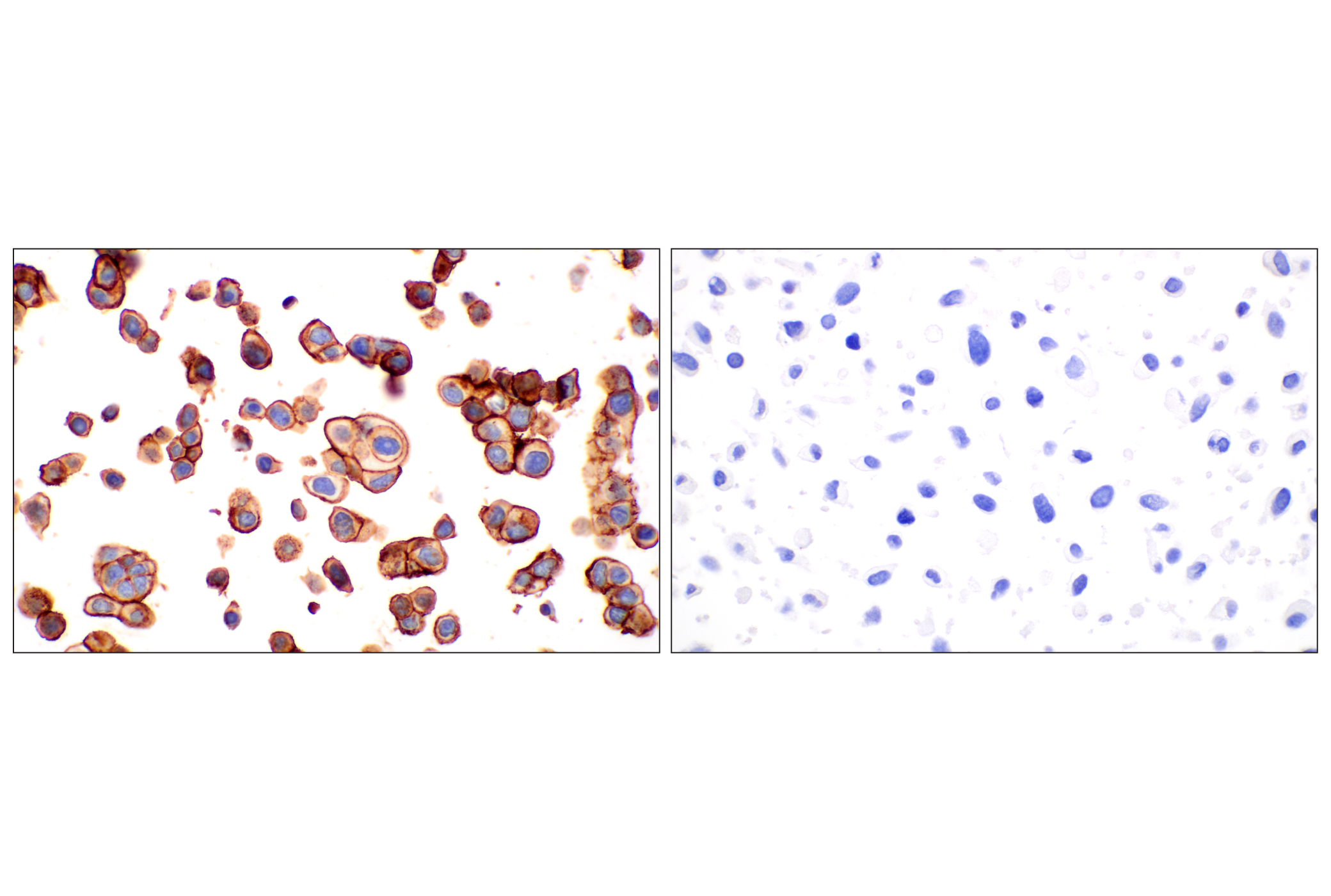 Immunohistochemistry Image 14: TACSTD2/TROP2 (F4W4J) Rabbit mAb (BSA and Azide Free)