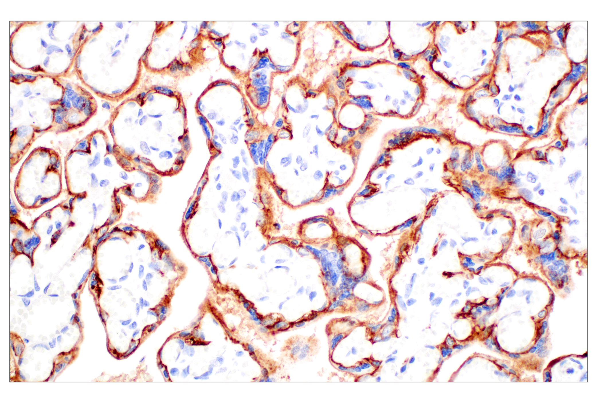 Immunohistochemistry Image 9: TACSTD2/TROP2 (F4W4J) Rabbit mAb (BSA and Azide Free)
