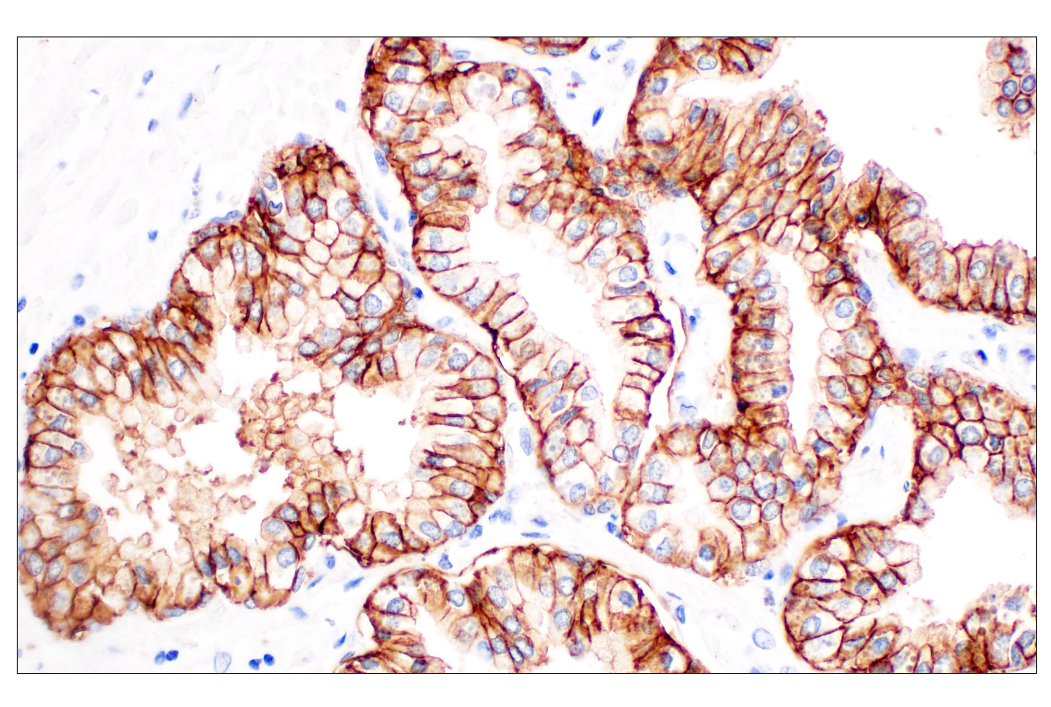 Immunohistochemistry Image 5: TACSTD2/TROP2 (F4W4J) Rabbit mAb (BSA and Azide Free)