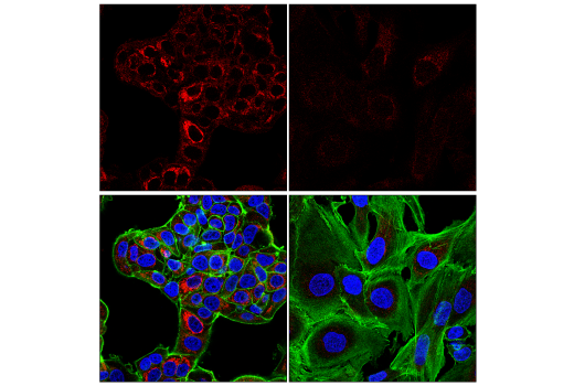 Immunofluorescence Image 1: Mcl-1 (D2W9E) Rabbit mAb (Alexa Fluor® 594 Conjugate)
