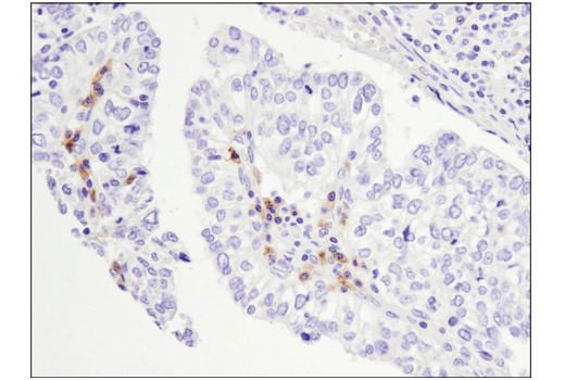 Immunohistochemistry Image 4: TNFRSF17/BCMA (E6D7B) Rabbit mAb