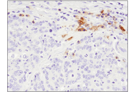 Immunohistochemistry Image 5: TNFRSF17/BCMA (E6D7B) Rabbit mAb