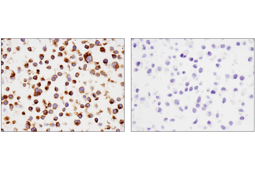 Immunohistochemistry Image 7: TNFRSF17/BCMA (E6D7B) Rabbit mAb