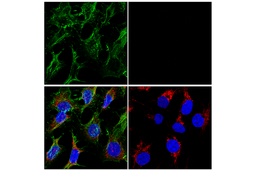 Immunofluorescence Image 2: β-Catenin (D10A8) XP® Rabbit mAb (Alexa Fluor® 488 Conjugate)