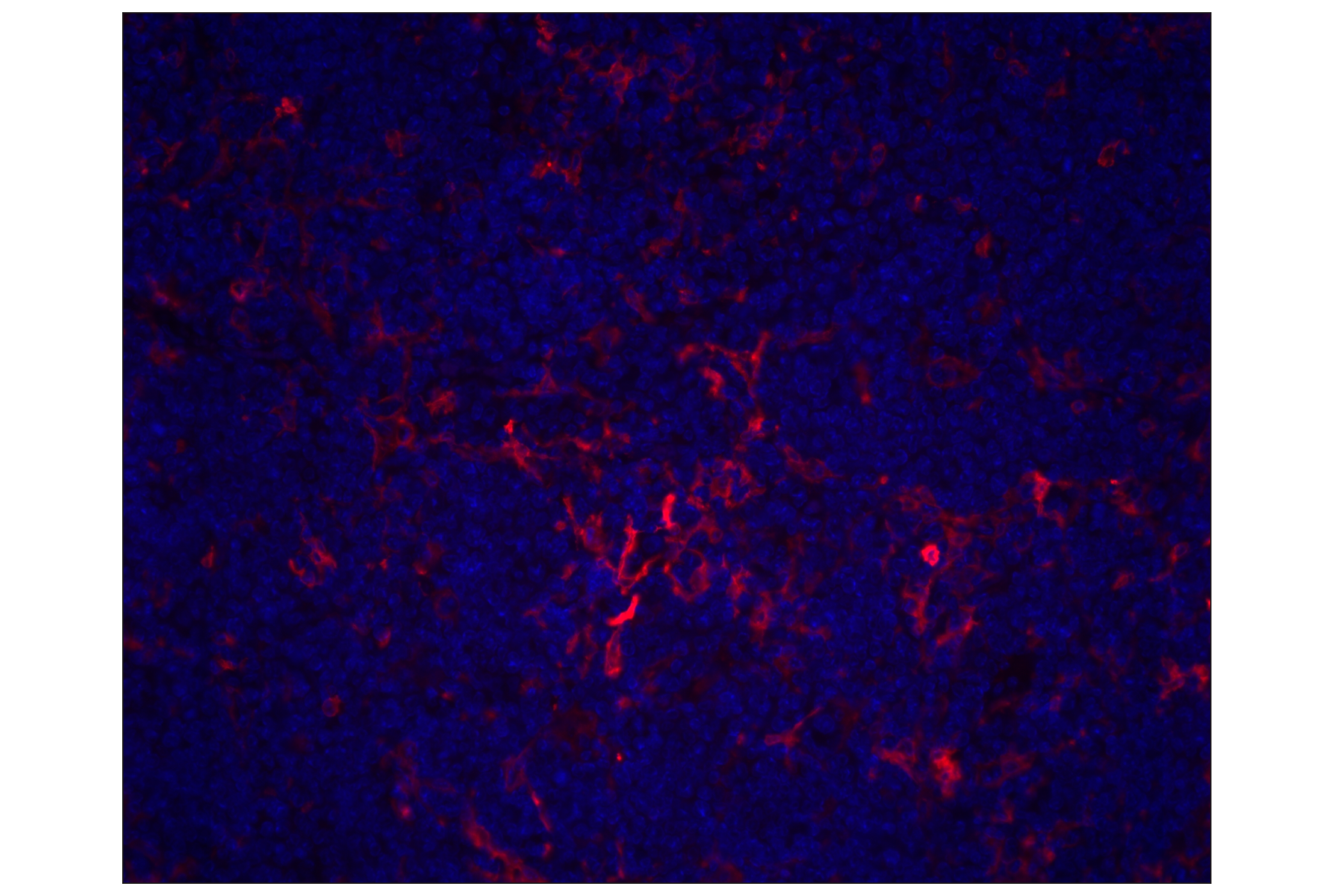 Immunohistochemistry Image 1: CD11c (D1V9Y) Rabbit mAb (Alexa Fluor® 647 Conjugate)