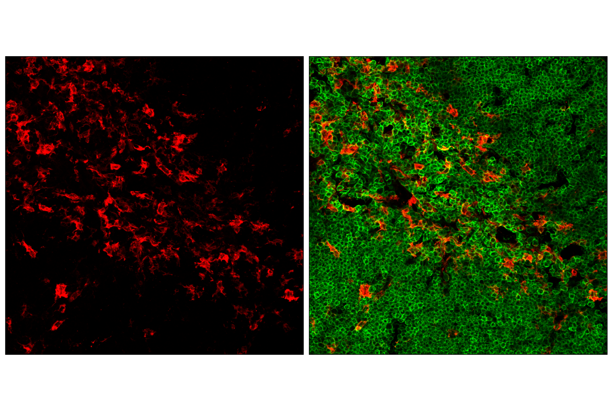 Immunofluorescence Image 4: CD11c (D1V9Y) Rabbit mAb (Alexa Fluor® 647 Conjugate)