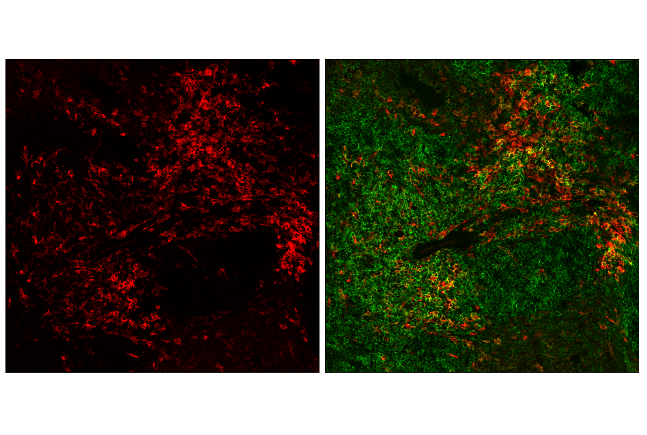 Immunofluorescence Image 3: CD11c (D1V9Y) Rabbit mAb (Alexa Fluor® 647 Conjugate)