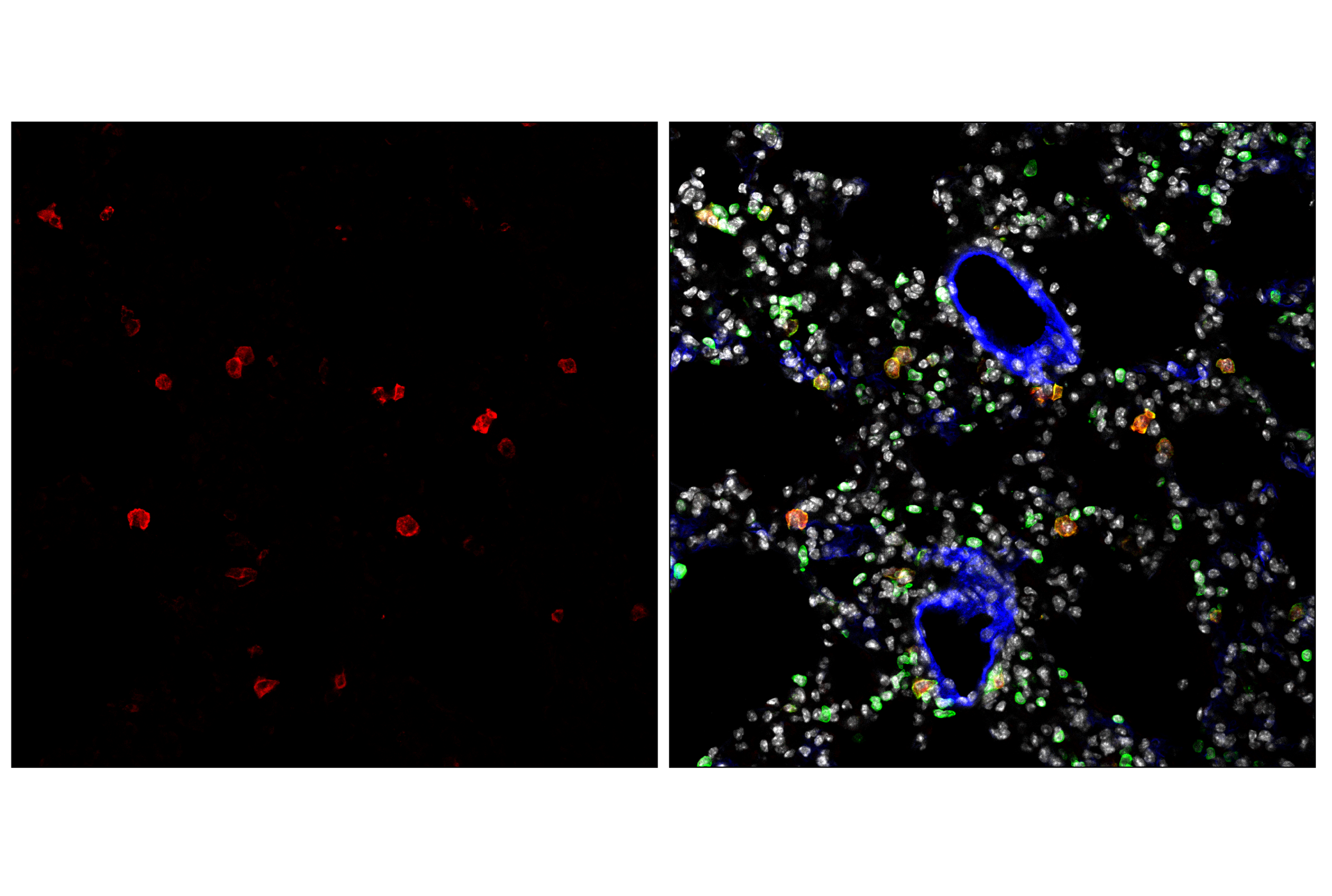Immunofluorescence Image 2: CD11c (D1V9Y) Rabbit mAb (Alexa Fluor® 647 Conjugate)
