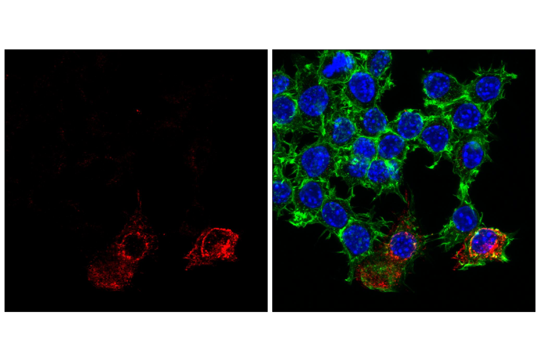 Immunofluorescence Image 1: CD11c (D1V9Y) Rabbit mAb (Alexa Fluor® 647 Conjugate)