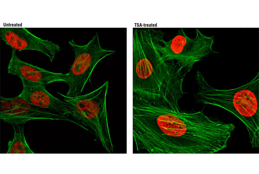 Immunofluorescence Image 1: Acetyl-Histone H3 (Lys9) (C5B11) Rabbit mAb (Alexa Fluor® 594 Conjugate)