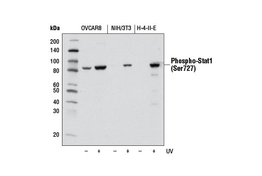  Image 13: IFN-γ Signaling Pathway Antibody Sampler Kit