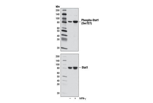  Image 21: IFN-γ Signaling Pathway Antibody Sampler Kit