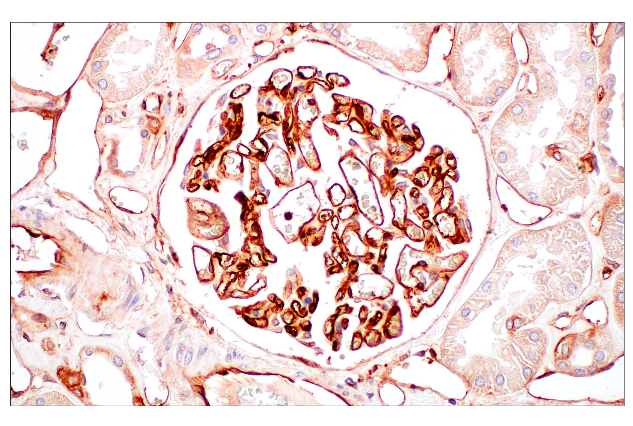 Immunohistochemistry Image 12: MHC Class I (EMR8-5) Mouse mAb