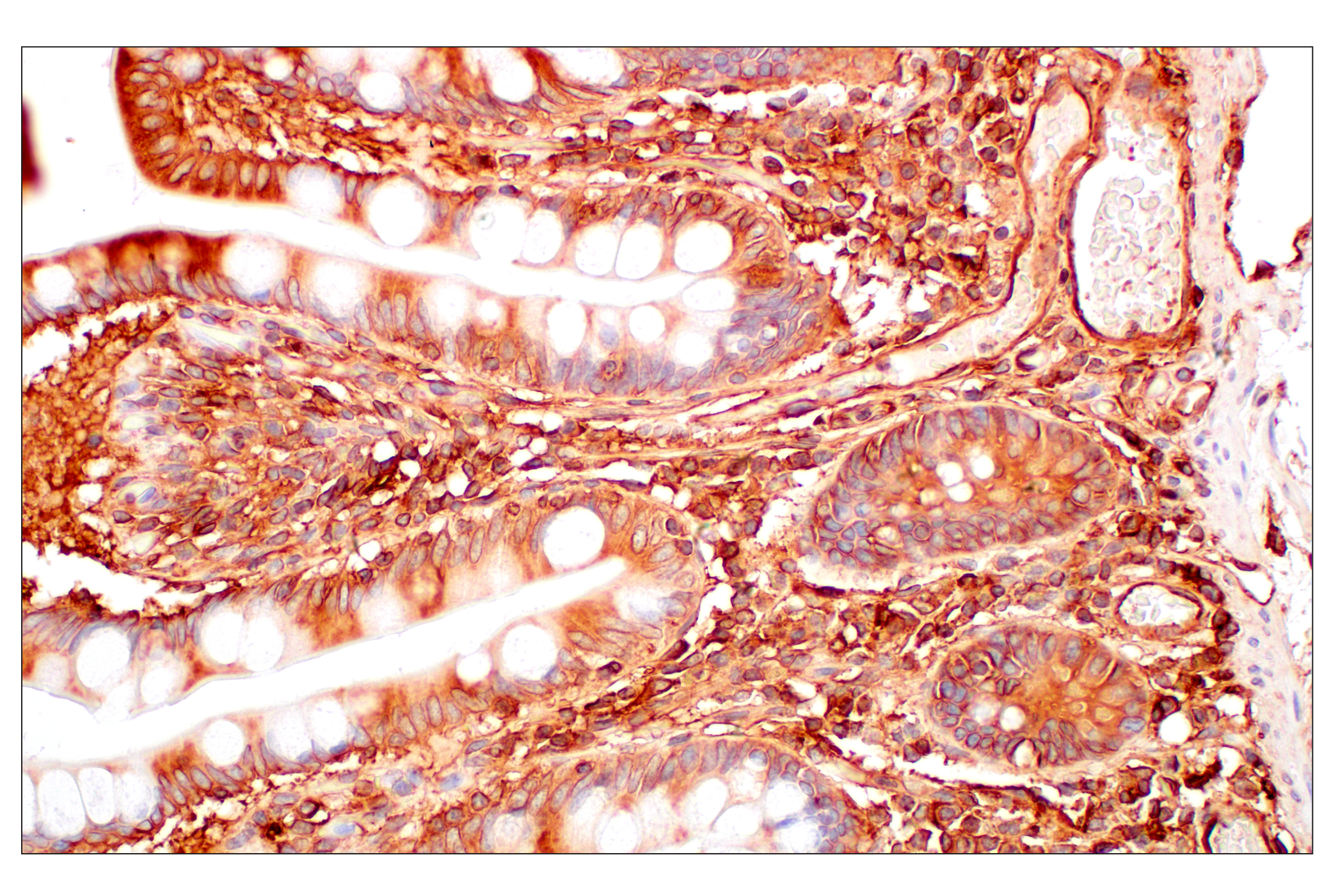 Immunohistochemistry Image 10: MHC Class I (EMR8-5) Mouse mAb