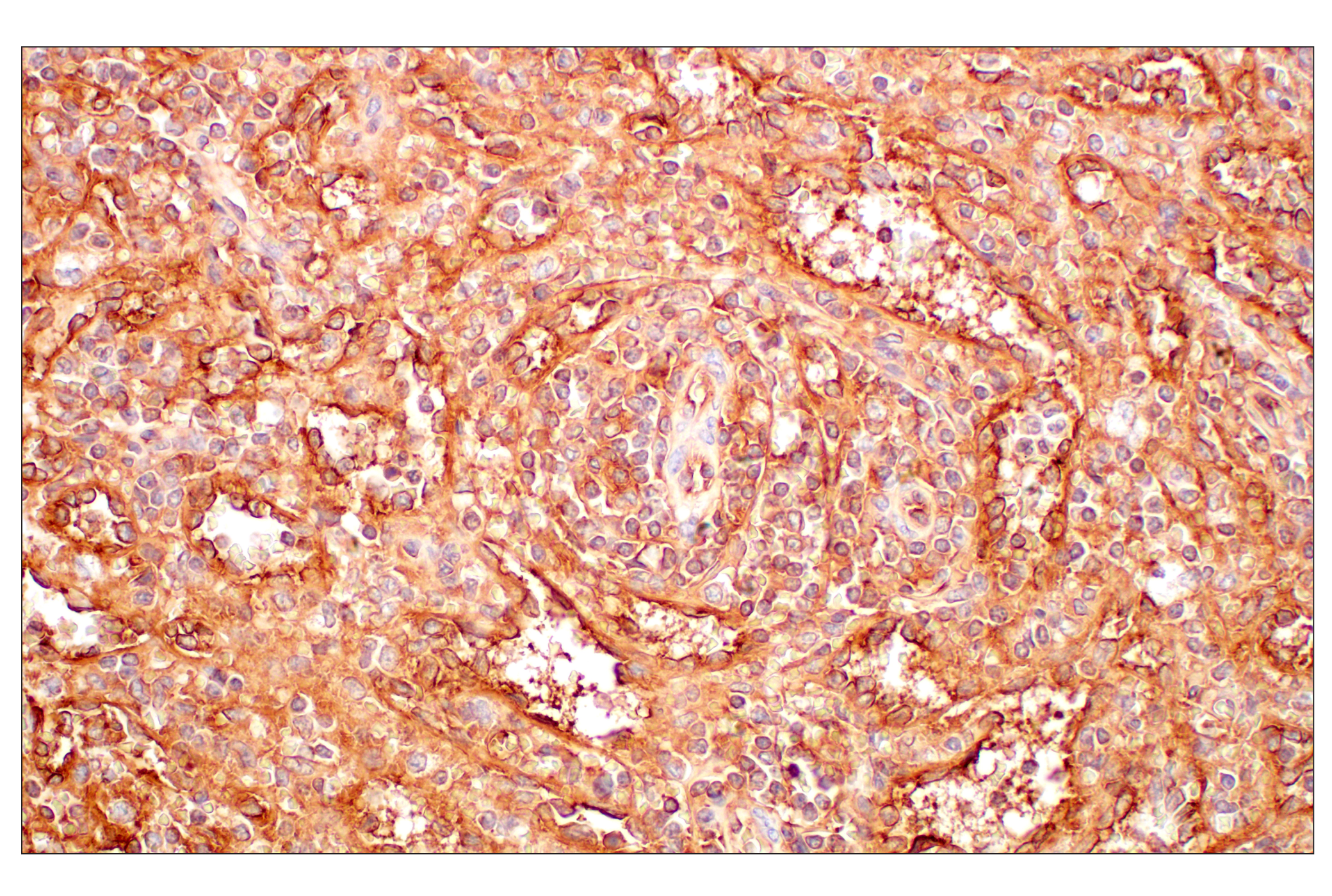 Immunohistochemistry Image 9: MHC Class I (EMR8-5) Mouse mAb