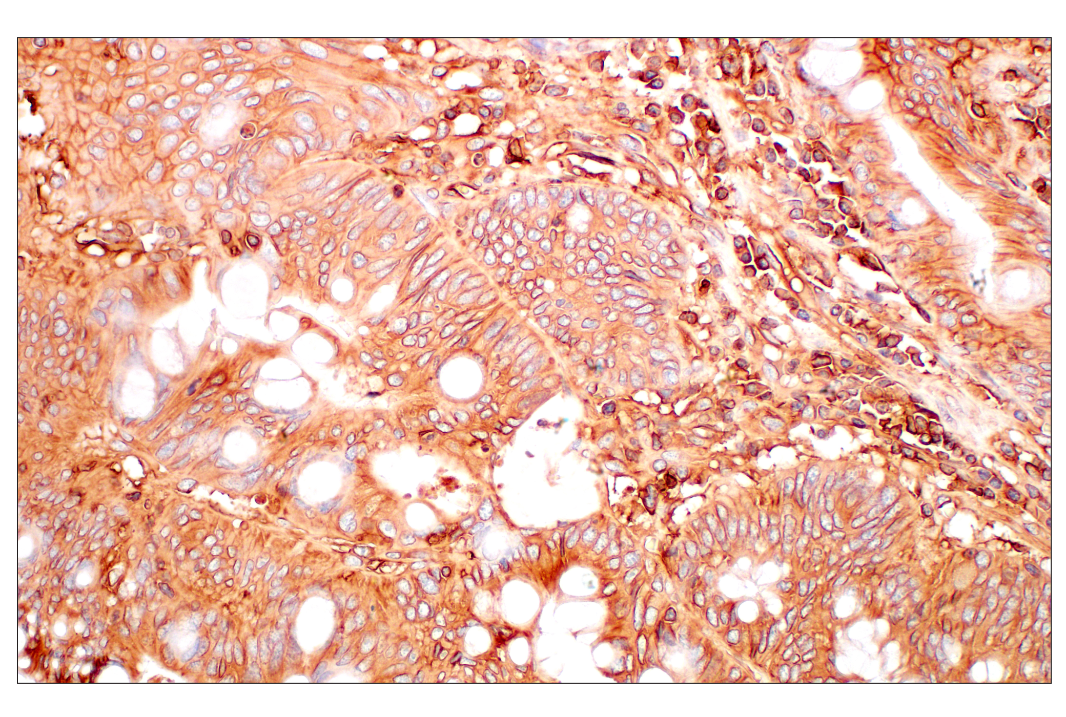 Immunohistochemistry Image 6: MHC Class I (EMR8-5) Mouse mAb