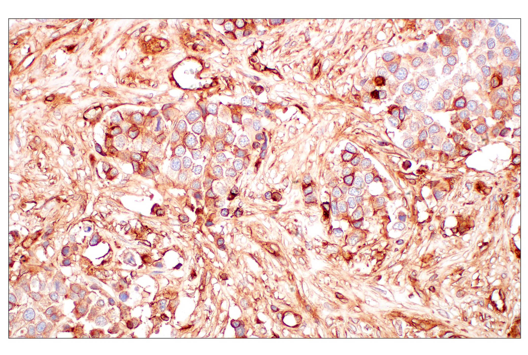 Immunohistochemistry Image 5: MHC Class I (EMR8-5) Mouse mAb