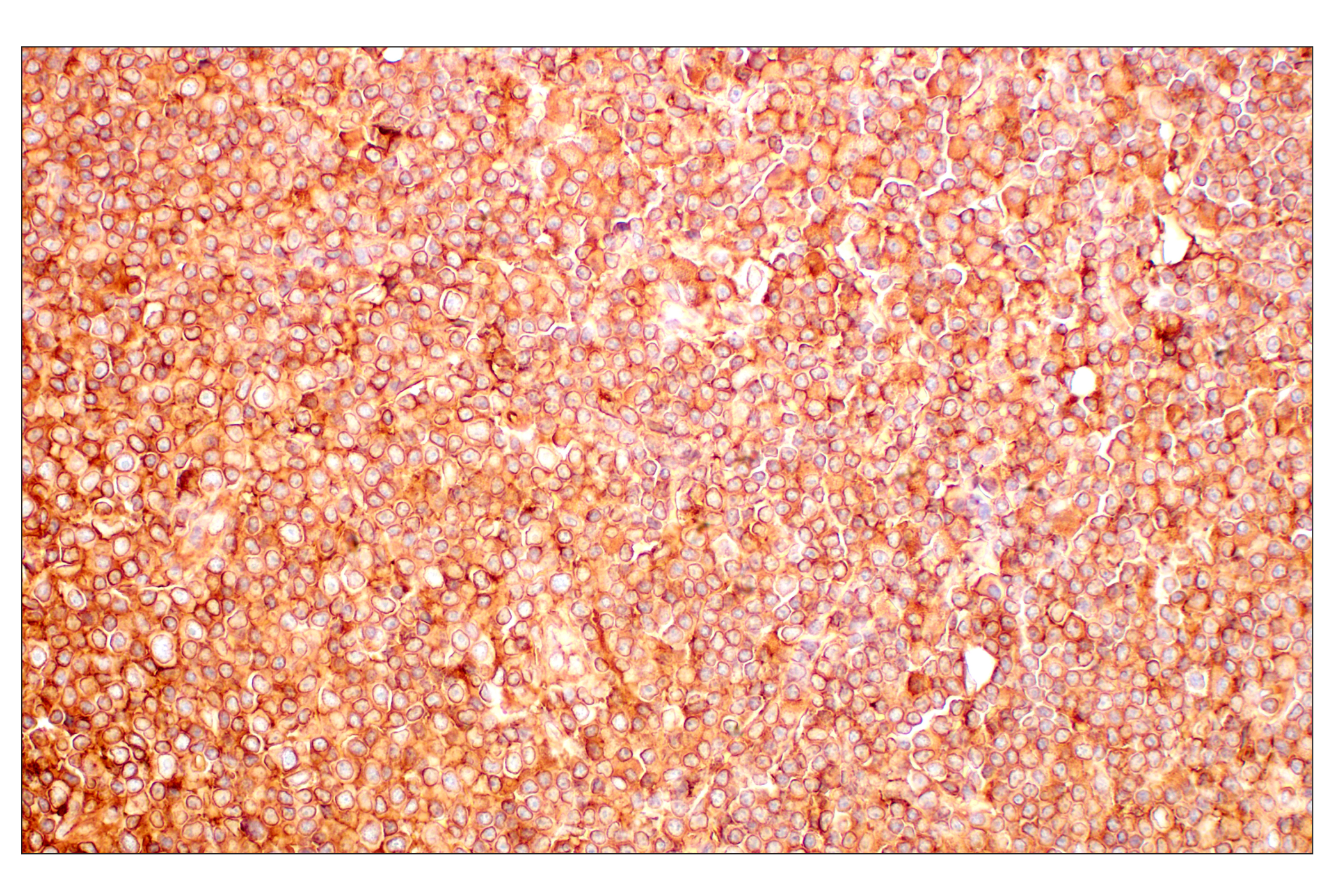 Immunohistochemistry Image 4: MHC Class I (EMR8-5) Mouse mAb